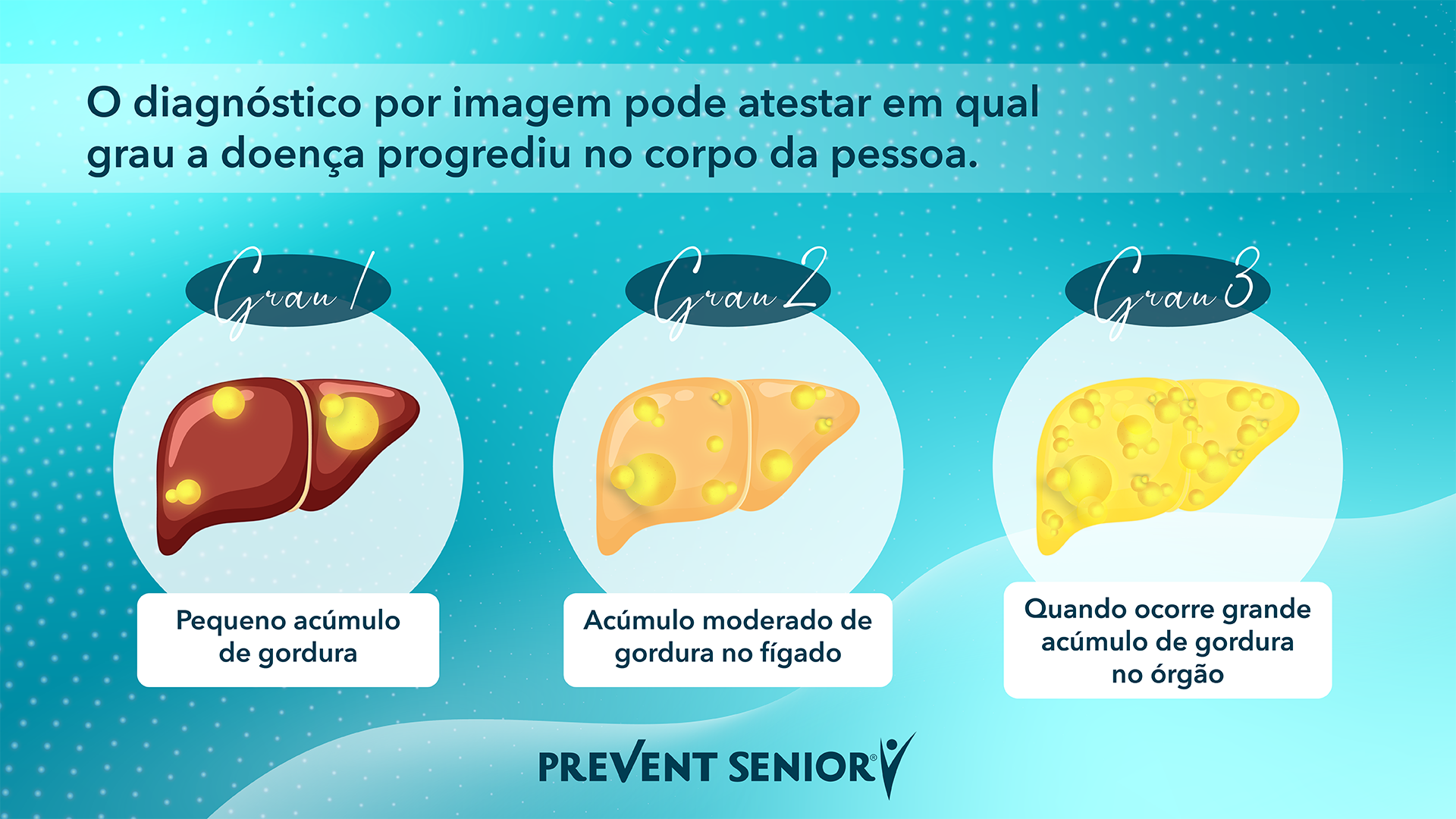 O diagnóstico por imagem pode atestar em qual grau a doença progrediu no corpo da pessoa.